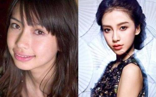 成人整牙攻略视频,揭秘整牙全过程与注意事项